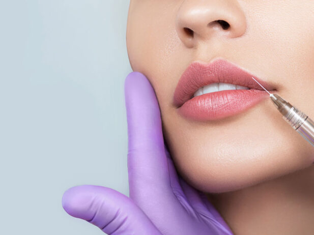 Ask a Dermatologist: Should I Get Fillers?